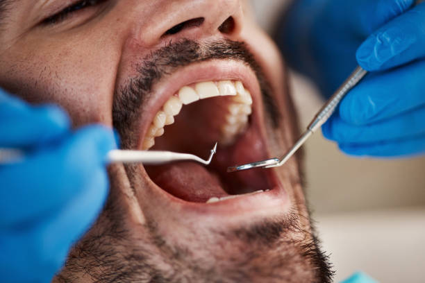 Best Emergency Treatment for Toothache in Wellsville, UT